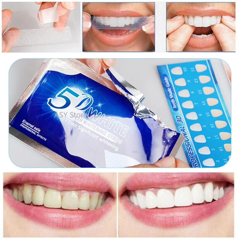 Tiras de clareamento de dentes em gel Kit dental de dente branco.