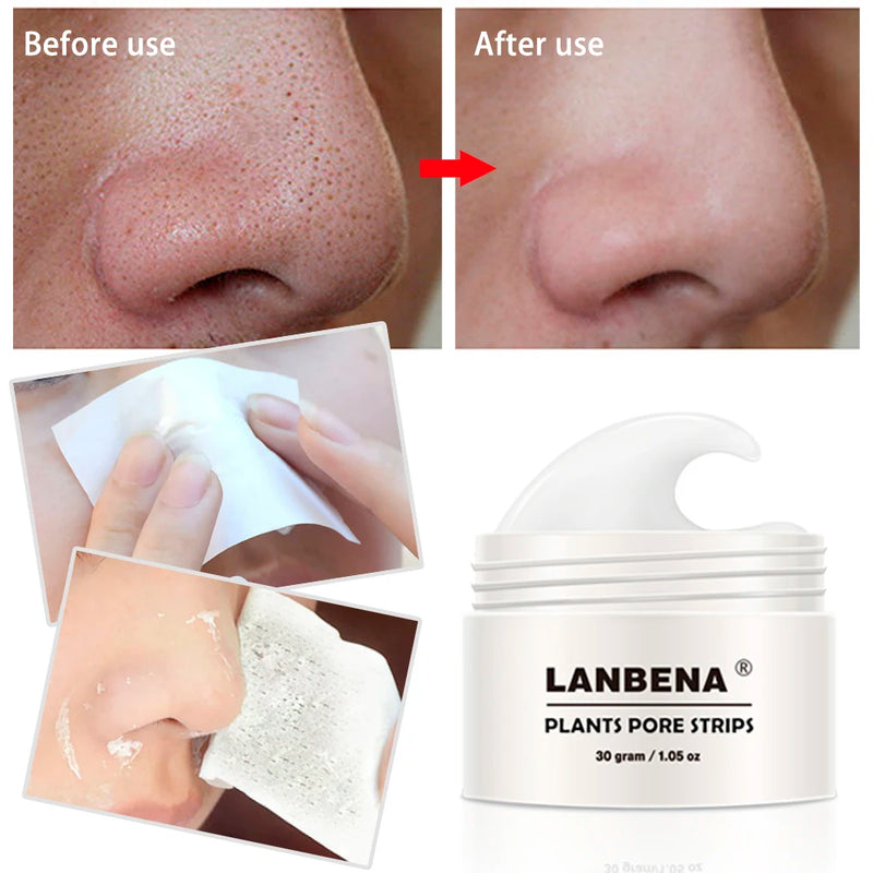 LANBÉNA-Removedor de cravos, máscara facial e limpeza facial.